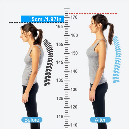 Smart Posture Corrector